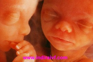 Fertility & IVF After Age 40